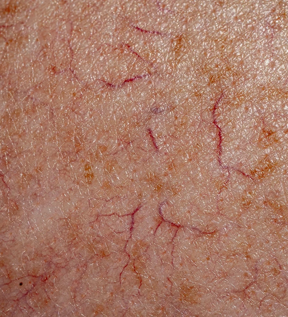 macro-shot-of-the-human-skin-with-veins-2025-02-02-15-21-42-utc-2